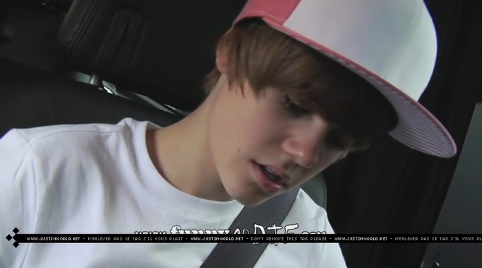jw0118 - 0_0 Bieber After the Dentist 0_0