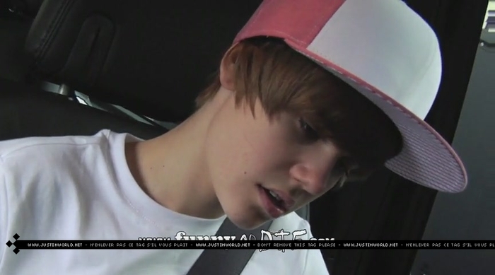 jw0121 - 0_0 Bieber After the Dentist 0_0