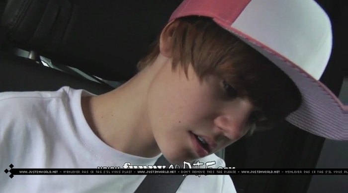 jw0122 - 0_0 Bieber After the Dentist 0_0