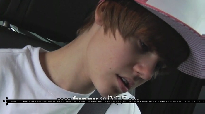 jw0124 - 0_0 Bieber After the Dentist 0_0