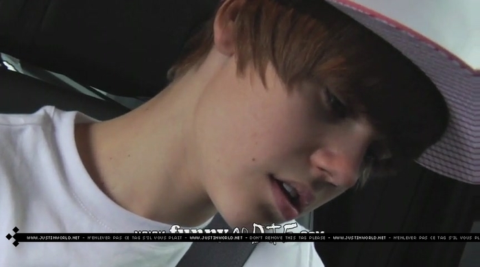 jw0125 - 0_0 Bieber After the Dentist 0_0
