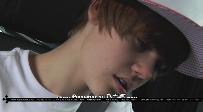 jw0126 - 0_0 Bieber After the Dentist 0_0
