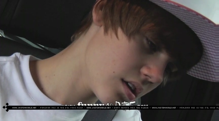 jw0127 - 0_0 Bieber After the Dentist 0_0