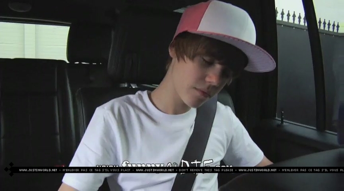 jw0128 - 0_0 Bieber After the Dentist 0_0