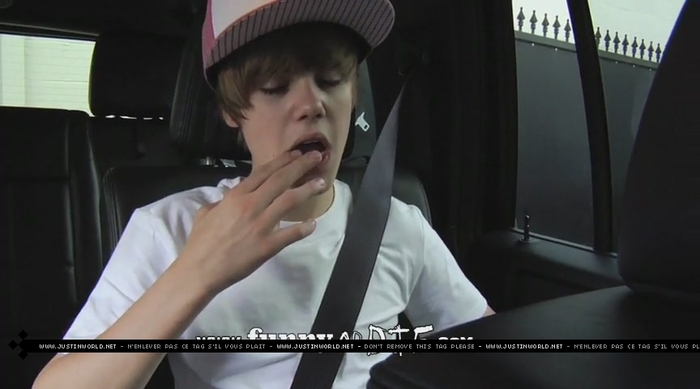 jw0138 - 0_0 Bieber After the Dentist 0_0