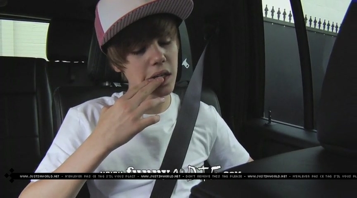 jw0141 - 0_0 Bieber After the Dentist 0_0