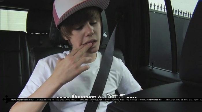 jw0143 - 0_0 Bieber After the Dentist 0_0