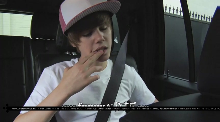 jw0145 - 0_0 Bieber After the Dentist 0_0
