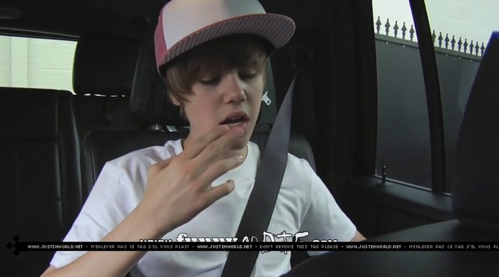 jw0148 - 0_0 Bieber After the Dentist 0_0