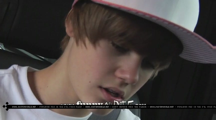 jw0149 - 0_0 Bieber After the Dentist 0_0