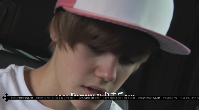 jw0150 - 0_0 Bieber After the Dentist 0_0