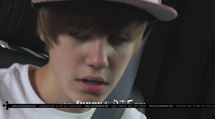 jw0152 - 0_0 Bieber After the Dentist 0_0
