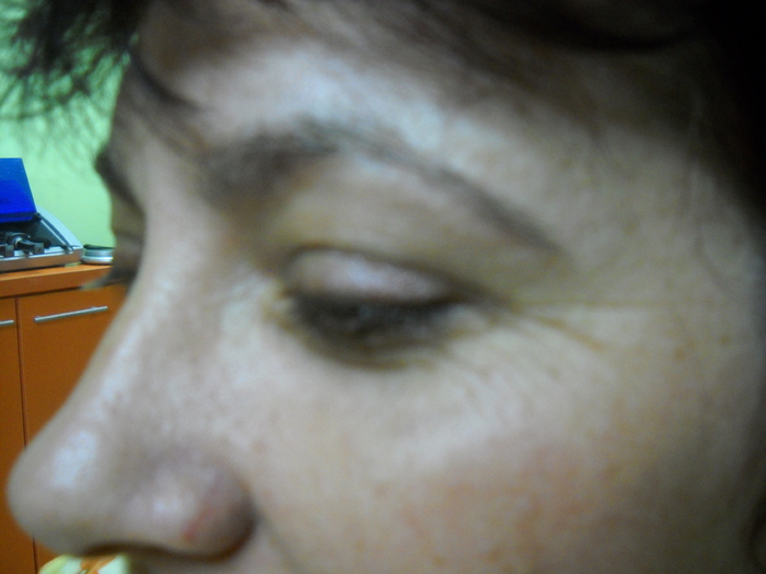 probleme la sprancene..