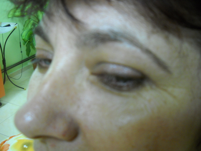 ....si cu ridurile...