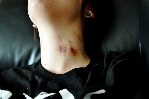 tumblr_l8r53tHgYg1qc9hd7o1_500_large - Diverse