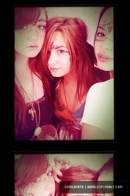 normal_536