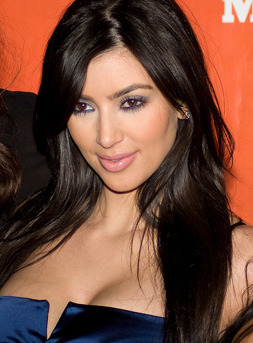 Kim-Kardashian-Botox