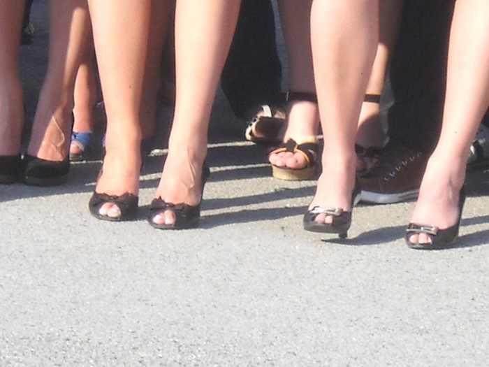 DESEURI la 18 ani.(varice)