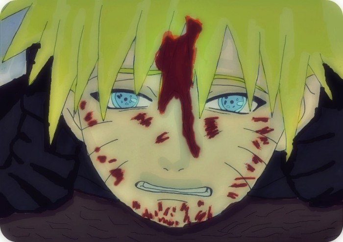 hurt_naruto_by_cutebutdeadlyinu-d2zzsi0 - resturi