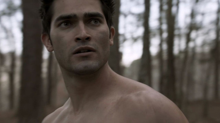 teen-wolf-x05-The-Tell-tyler-hoechlin-23978439-1280-720 - xx Season 1 xx