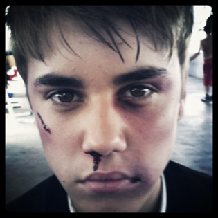 justin-bieber-bloody-nose-featured