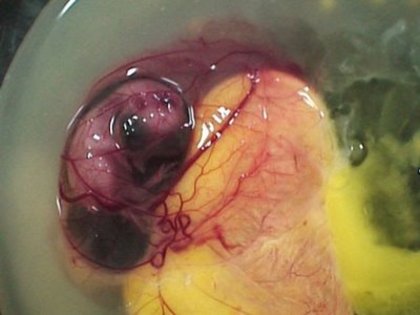 11 - dezvoltare embrionara gaina