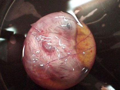 15 - dezvoltare embrionara gaina