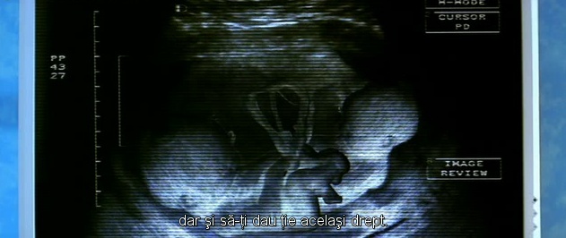 ``dar sa-ti dau si tie acelasi drept``