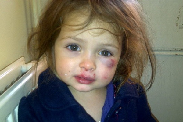 copil-violenta-gradinite[1] - Uite ce a patit o fetita de 3 ani din SUA la gradinita