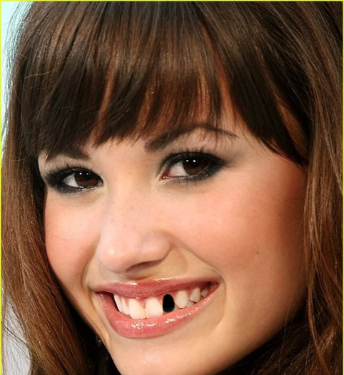 Demi-Lovato-demi-lovato-9711787-863-939 - Cum arata vedeta ta preferata fara un dinte