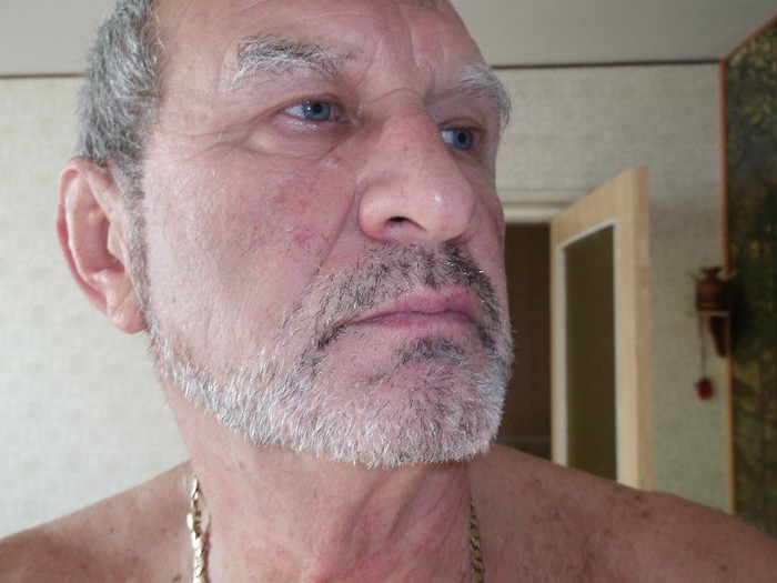 metamorfoze.........din cauza febrei