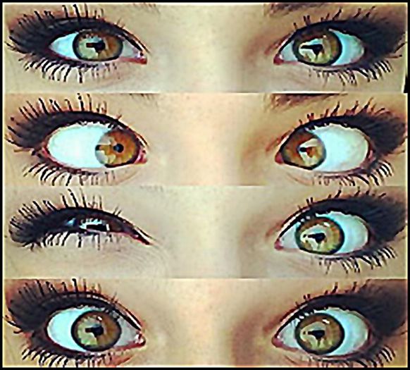  - o-Poze artistice