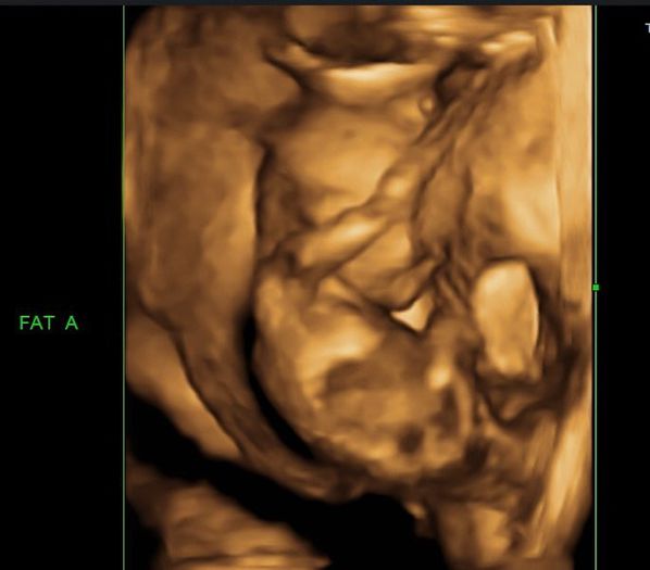 246772_190207747694382_7386337_n