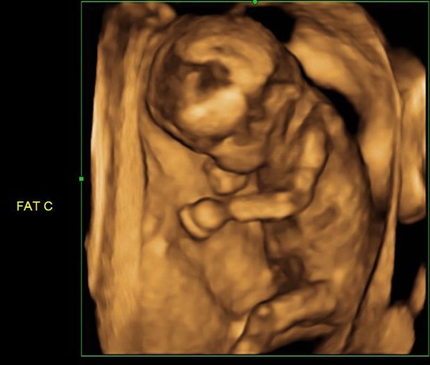 247251_190227651025725_8294755_n