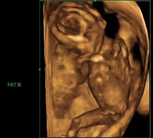 248406_190227464359077_291138_n