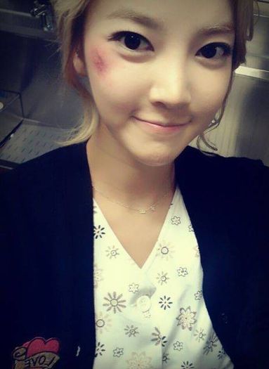 ns-yoonji-scar-makeup