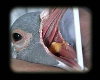 Galben In gat (tricomonoza)