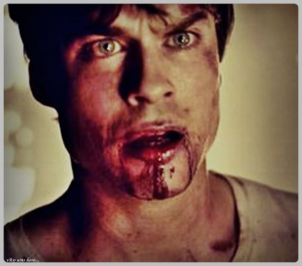 #► |o impinge si urla| NU MA ATINGE... |apoi se sterge cu mainile[cl]; si intinde tot bl;;ood`u pe fata lui| #Dylan... O_o....
