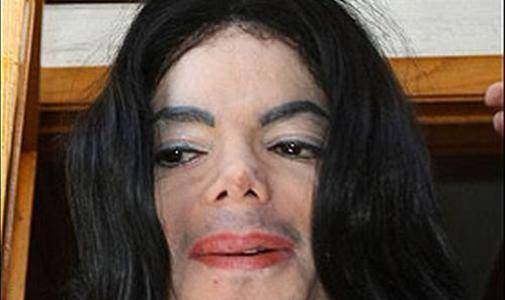 michael_jackson_se_opereaz___azi_34c58e2