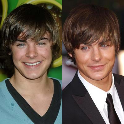 zac-efron-plastic-surgery - zac efrond