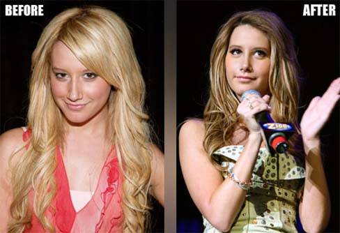 ashley-tisdale-nose - ashley tisdale