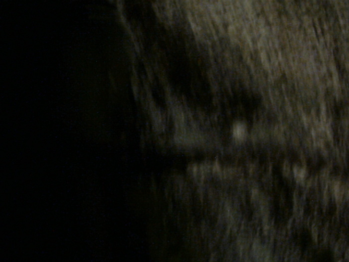 AAAA0560