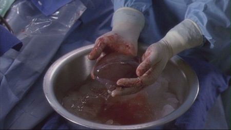 day thirty two. ⭒⭑⭒ ltd be a waste of organs.
