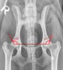 examen radiologique pour la displasye 1