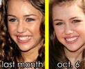 miley-cyrus-new-teeth