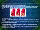 10 alimente care scad colesterolul