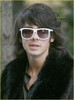 joe-jonas-plastic-surgery-01
