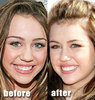 miley-cyrus-teeth