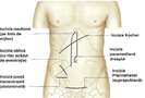 corpul uman anatomie imagini poze-53
