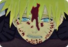 hurt_naruto_by_cutebutdeadlyinu-d2zzsi0